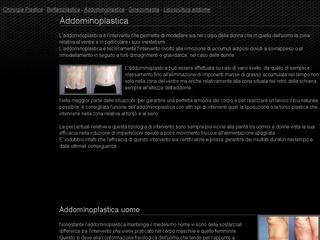 addominoplastica uomo
